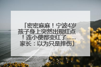 密密麻麻！宁波4岁孩子身上突然出现红点！连小便都变红了……家长：以为只是摔伤